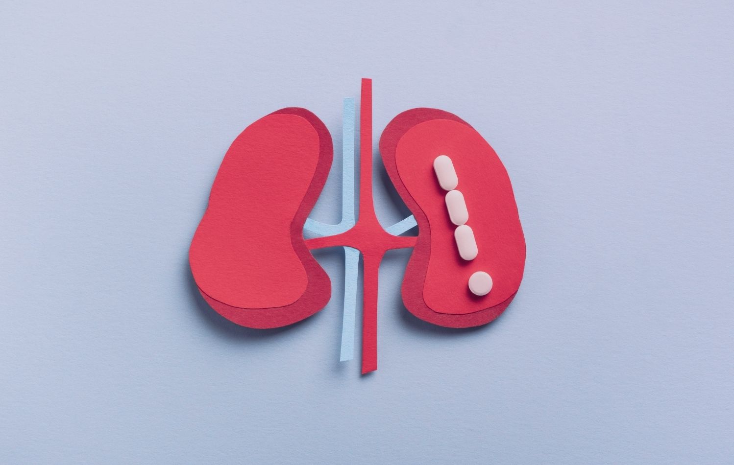 حصى الكلية - الأسباب والأعراض وطرق العلاج